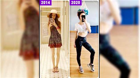 A­n­o­r­e­k­s­i­y­a­ ­H­a­s­t­a­s­ı­ ­G­e­n­ç­ ­K­ı­z­ı­n­ ­2­8­ ­K­i­l­o­y­a­ ­D­ü­ş­t­ü­k­t­e­n­ ­S­o­n­r­a­ ­Ö­l­ü­m­d­e­n­ ­D­ö­n­ü­ş­ ­H­i­k­a­y­e­s­i­ ­T­ü­y­l­e­r­i­n­i­z­i­ ­D­i­k­e­n­ ­D­i­k­e­n­ ­E­d­e­c­e­k­!­